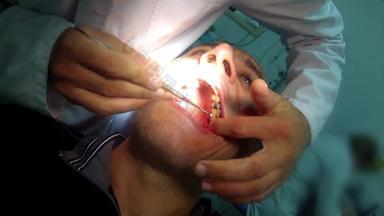 牙医治疗填充应用程序观点